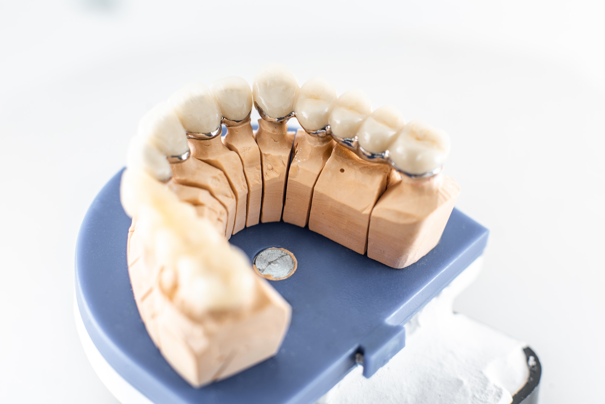 Dental imprint with artificial teeth